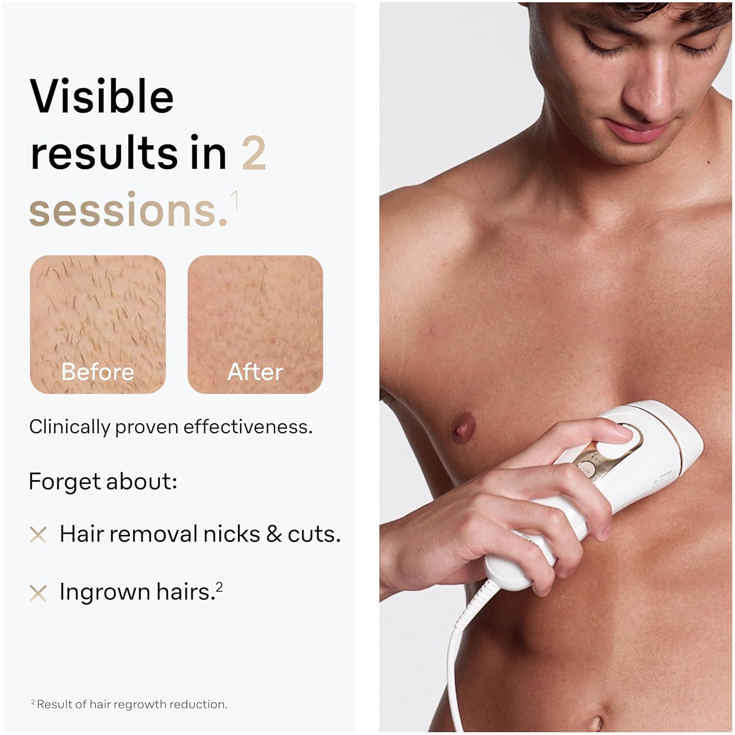 Braun Smart IPL Silk·Expert Pro 5: At Home Alternative to Laser Hair Removal with Wide Cap and Leather Pouch IPL5145